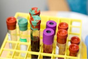 Can You Argue Forensic Testing was Flawed?